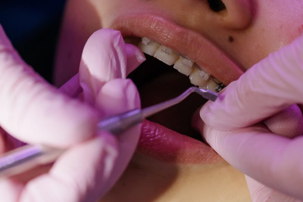 Orthodontic treatment in San Antonio
