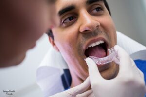 Closing the Gaps Between Teeth with Orthodontics Treatment